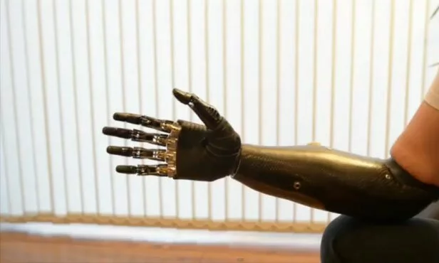 most-advanced-prosthetic-limb